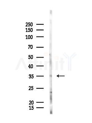 OR2V2 Antibody - Western blot analysis of lysates from Rat liver, using OR2V2 Antibody at 1/1000 dilution.
