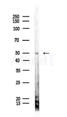 Alas1 Antibody - Western blot analysis of lysates from Mouse lung, using Alas1 Antibody at 1/1000 dilution.