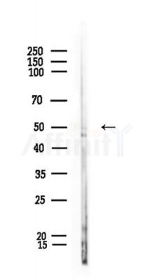 Alas1 Antibody - Western blot analysis of lysates from Rat spleen, using Alas1 Antibody at 1/1000 dilution.