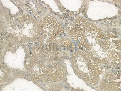 alpha Tubulin 4A Antibody - DF2901 at 1/100 staining human normal kidney tissue by IHC-P.