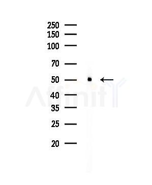 alpha Tubulin 4A Antibody - Western blot analysis of lysates from EC304 cells, using alpha Tubulin 4A Antibody at 1/1000 dilution.