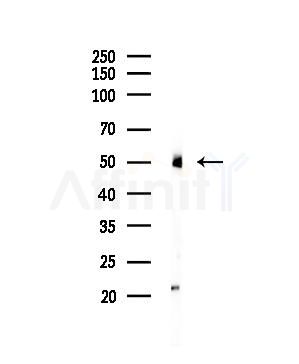 alpha Tubulin 4A Antibody - Western blot analysis of lysates from COLO205 cells, using alpha Tubulin 4A Antibody at 1/1000 dilution.