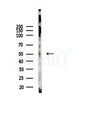 beta I Tubulin Antibody - Western blot analysis of lysates from EC304 cells(heat-shock, 45min treatment), using beta I Tubulin Antibody at 1/1000 dilution.