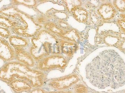 Cubilin Antibody - DF2914 at 1/100 staining human normal kidney tissue by IHC-P.