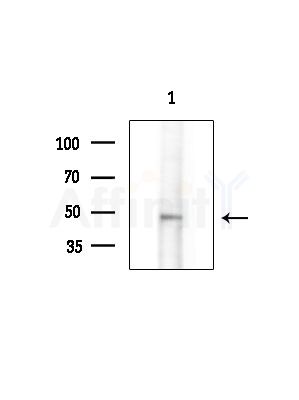 HAPLN1 Antibody - Western blot analysis of extracts from Hela cells(LPS 4h treatment), using HAPLN1 Antibody at 1/1000 dilution.