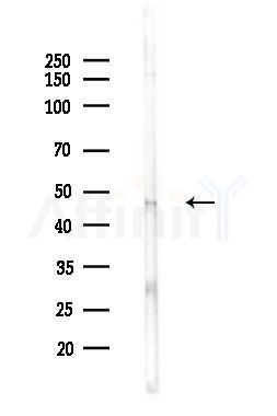 HAPLN1 Antibody - Western blot analysis of lysates from Hela cells(LPS 4h treatment), using HAPLN1 Antibody at 1/1000 dilution.