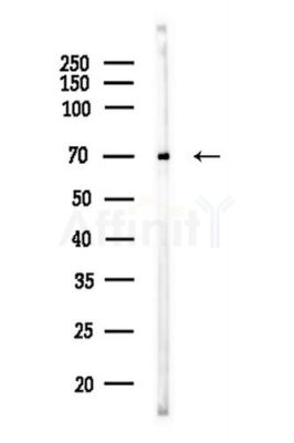 FUBP1 Antibody - Western blot analysis of lysates from COLO205 cells(UV,30min treatment), using FUBP1 Antibody at 1/1000 dilution.