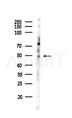 HAPLN1 Antibody - Western blot analysis of lysates from PC12 cells(LPS,4h treatment), using HAPLN1 Antibody at 1/1000 dilution.