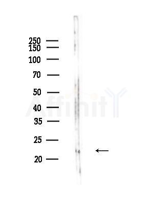 Id1 Antibody - Western blot analysis of lysates from Mouse liver, using Id1 Antibody at 1/1000 dilution.