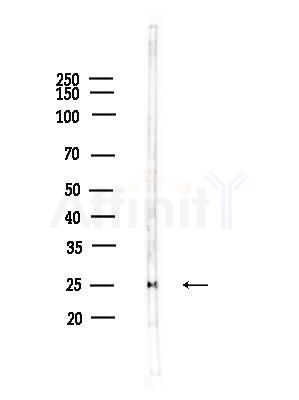 Id1 Antibody - Western blot analysis of lysates from HepG2 cells(heat-shock,45min treatment), using Id1 Antibody at 1/1000 dilution.