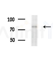 LRP1/CD91 Antibody - Western blot analysis of extracts from Hela cells(heat-shock,45min treatment), using LRP1/CD91 Antibody at 1/1000 dilution.