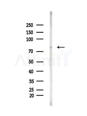 LRP1/CD91 Antibody - Western blot analysis of lysates from Hela cells(heat-shock,45min treatment), using LRP1/CD91 Antibody at 1/1000 dilution.