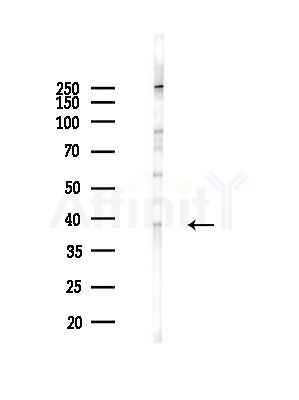 HLA Class I Antibody - Western blot analysis of lysates from Mouse brain, using HLA Class I Antibody at 1/1000 dilution.
