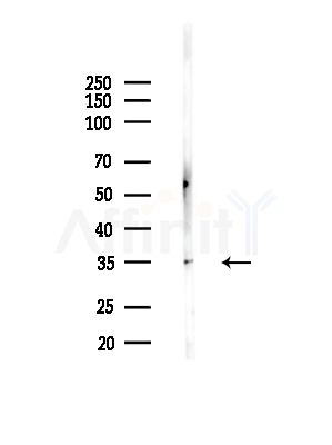 Otx1 Antibody - Western blot analysis of lysates from PC12 cells(LPS,4h treatment), using Otx1 Antibody at 1/1000 dilution.