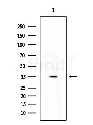 Phospho-Cdk1/2 (Thr14) Antibody - Western blot analysis of lysates from COLO205 cells, using Phospho-Cdk1/2 (Thr14) Antibody at 1/1000 dilution.