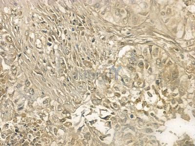 Phospho-Cdk1/2 (Thr14) Antibody - DF2944 at 1/100 staining mouse ovarian tissue by IHC-P.