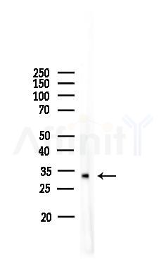 Phospho-Cdk1/2 (Thr14) Antibody - Western blot analysis of lysates from COLO205 cells, using Phospho-Cdk1/2 (Thr14) Antibody at 1/1000 dilution.