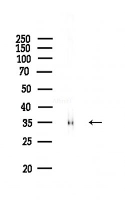 Phospho-Histone H1.3 (Thr18) Antibody - Western blot analysis of lysates from COLO205 cells(heat-shock,45min treatment), using Phospho-Histone H1.