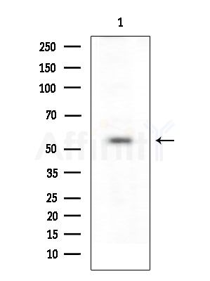 Phospho-PAK1/2/3 (Ser144+Ser141+Ser139) Antibody - Western blot analysis of lysates from Hela cells, using Phospho-PAK1/2/3 (Ser144+Ser141+Ser139) Antibody at 1/1000 dilution.