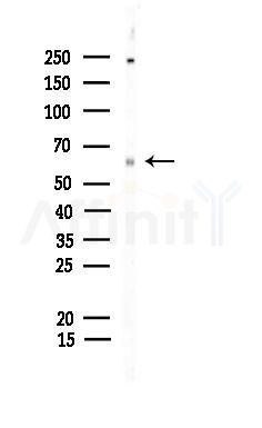 Phospho-PAK1/2/3 (Ser144+Ser141+Ser139) Antibody - Western blot analysis of lysates from Hela cells, using Phospho-PAK1/2/3 (Ser144+Ser141+Ser139) Antibody at 1/1000 dilution.