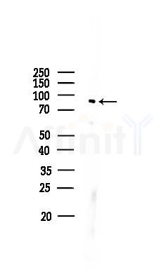 Phospho-RSK1 p90 (Thr359+Ser363) Antibody - Western blot analysis of lysates from COLO205 cells, using Phospho-RSK1 p90 (Thr359+Ser363) Antibody at 1/1000 dilution.