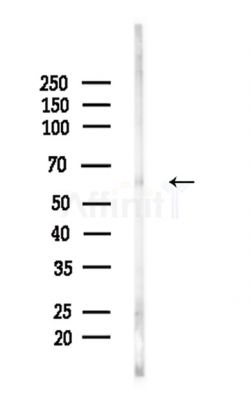 Phospho-Smad5 (Ser463/Ser465) Antibody - Western blot analysis of lysates from Mouse brain, using Phospho-Smad5 (Ser463/Ser465) Antibody at 1/1000 dilution.