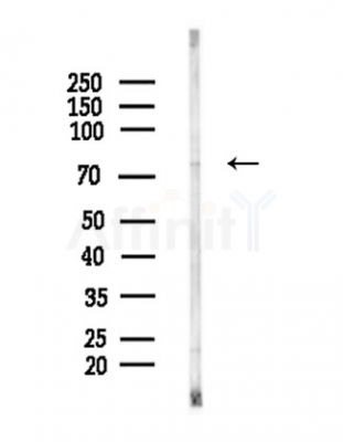 PI 3 Kinase p85 beta Antibody - Western blot analysis of lysates from COLO205 cells(heat-shock,45min treatment), using PI 3 Kinase p85 beta Antibody at 1/1000 dilution.