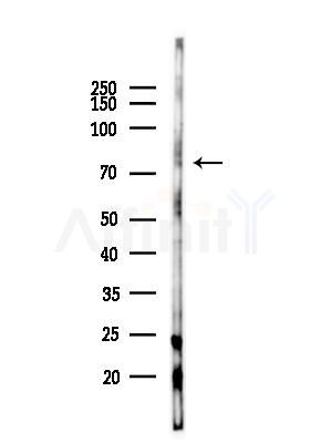 PRC1 Antibody - Western blot analysis of lysates from LoVo cells(heat-shock,45min treatment), using PRC1 Antibody at 1/1000 dilution.