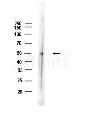 PTBP2 Antibody - Western blot analysis of lysates from Mouse liver, using PTBP2 Antibody at 1/1000 dilution.