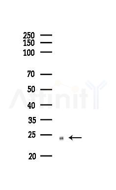 Rho A + B + C Antibody - Western blot analysis of lysates from PC12 cells(LPS,4h treatment), using Rho A + B + C Antibody at 1/1000 dilution.