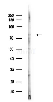 SATB2 Antibody - Western blot analysis of lysates from Mouse testis, using SATB2 Antibody at 1/1000 dilution.
