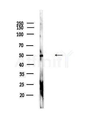 Acetyl-alpha-Tubulin (Lys40) Antibody - Western blot analysis of lysates from A375 cells(starvation,24h treatment), using Acetyl-alpha-Tubulin (Lys40) Antibody at 1/1000 dilution.