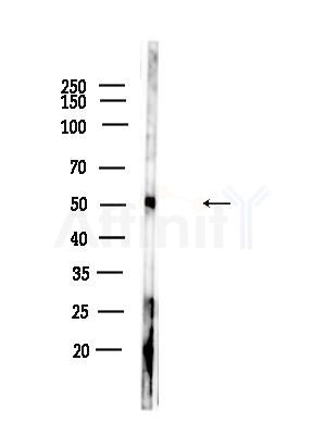 Acetyl-alpha-Tubulin (Lys40) Antibody - Western blot analysis of lysates from Rat lung, using Acetyl-alpha-Tubulin (Lys40) Antibody at 1/1000 dilution.