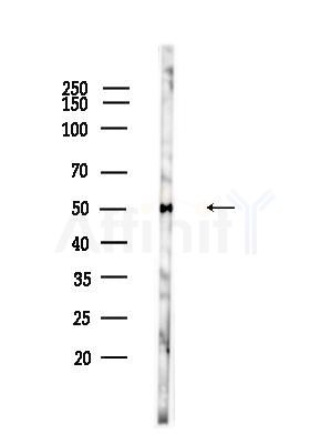 Acetyl-alpha-Tubulin (Lys40) Antibody - Western blot analysis of lysates from Hela cells(heat-shock,45min treatment), using Acetyl-alpha-Tubulin (Lys40) Antibody at 1/1000 dilution.