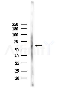 Phospho-SQSTM1/p62 (Ser403) Antibody - Western blot analysis of lysates from Mouse lung, using Phospho-SQSTM1/p62 (Ser403) Antibody at 1/1000 dilution.