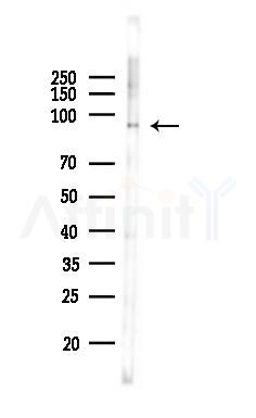 Phospho-beta Catenin (Ser33/Ser37/Thr41) Antibody - Western blot analysis of lysates from PC12 cells(LPS,4h treatment), using Phospho-beta Catenin (Ser33/Ser37/Thr41) Antibody at 1/1000 dilution.