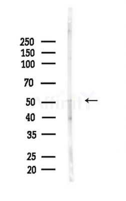 Phospho-p57 Kip2 (Thr310) Antibody - Western blot analysis of lysates from Mouse brain, using Phospho-p57 Kip2 (Thr310) Antibody at 1/1000 dilution.