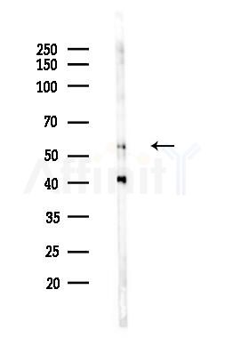 p57 Kip2 Antibody - Western blot analysis of lysates from Hela cells(LPS 4h treatment), using p57 Kip2 Antibody at 1/1000 dilution.