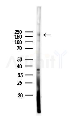 Phospho-LRP6 (Ser1490) Antibody - Western blot analysis of lysates from COLO205 cells, using Phospho-LRP6 (Ser1490) Antibody at 1/1000 dilution.
