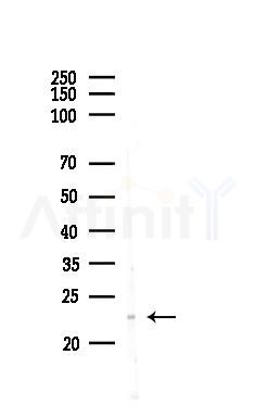 Phospho-FADD (Ser194) Antibody - Western blot analysis of lysates from PC12 cells(LPS,4h treatment), using Phospho-FADD (Ser194) Antibody at 1/1000 dilution.