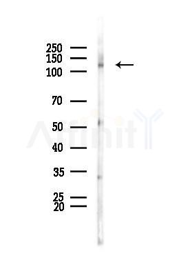JMY Antibody - Western blot analysis of lysates from Rat brain, using JMY Antibody at 1/1000 dilution.