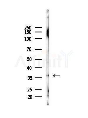 PDLIM1 Antibody - Western blot analysis of lysates from Mouse liver, using PDLIM1 Antibody at 1/1000 dilution.