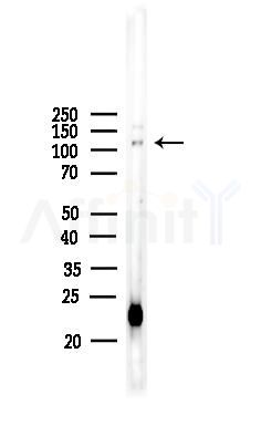 TAF4 Antibody - Western blot analysis of lysates from COLO205 cells, using TAF4 Antibody at 1/1000 dilution.