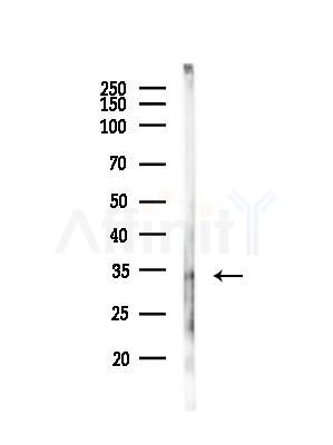 TTF2 Antibody - Western blot analysis of lysates from Rat liver, using TTF2 Antibody at 1/1000 dilution.