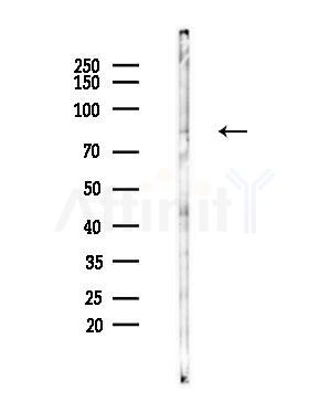 VWA5A Antibody - Western blot analysis of lysates from LoVo cells(heat-shock,45min treatment), using VWA5A Antibody at 1/1000 dilution.
