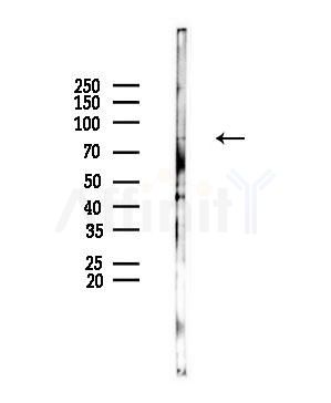 VWA5A Antibody - Western blot analysis of lysates from HUVEC cells(UV,30min treatment), using VWA5A Antibody at 1/1000 dilution.