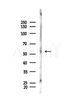 KLF11 Antibody - Western blot analysis of lysates from B16F10-LUC cells(starvation,24h treatment), using KLF11 Antibody at 1/1000 dilution.