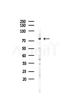 AKAP8 Antibody - Western blot analysis of lysates from Mouse testis, using AKAP8 Antibody at 1/1000 dilution.