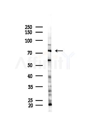 AKAP8 Antibody - Western blot analysis of lysates from B16F10-LUC cells(starvation,24h treatment), using AKAP8 Antibody at 1/1000 dilution.