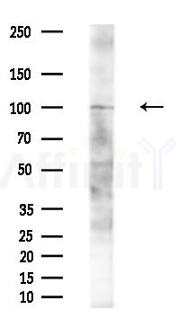 ZNF387 Antibody - Western blot analysis of extracts from A375 cells(heat-shock,45min treatment), using ZNF387 Antibody at 1/1000 dilution.